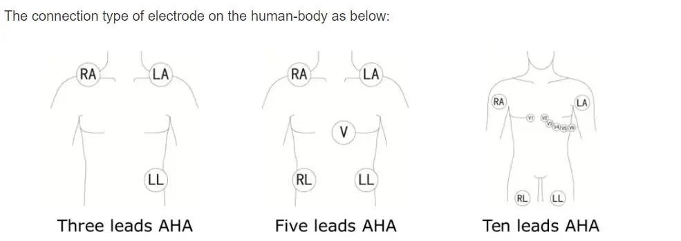 Samhæfður Bionet BM3 BM5 eins stykki hjartalínuritstrengur með víravírum, AHA, 3-leiða, smellu, rauðum 12pins